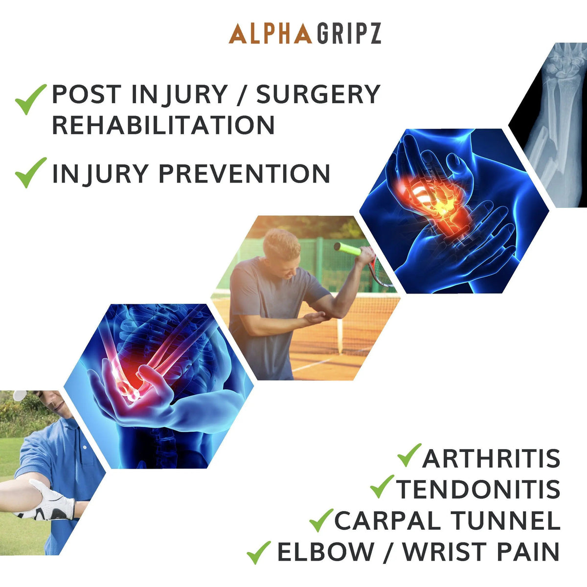 ALPHA GRIPZ™ PT Recovery - Forearm Strengthening, Performance, Recovery and Resilience