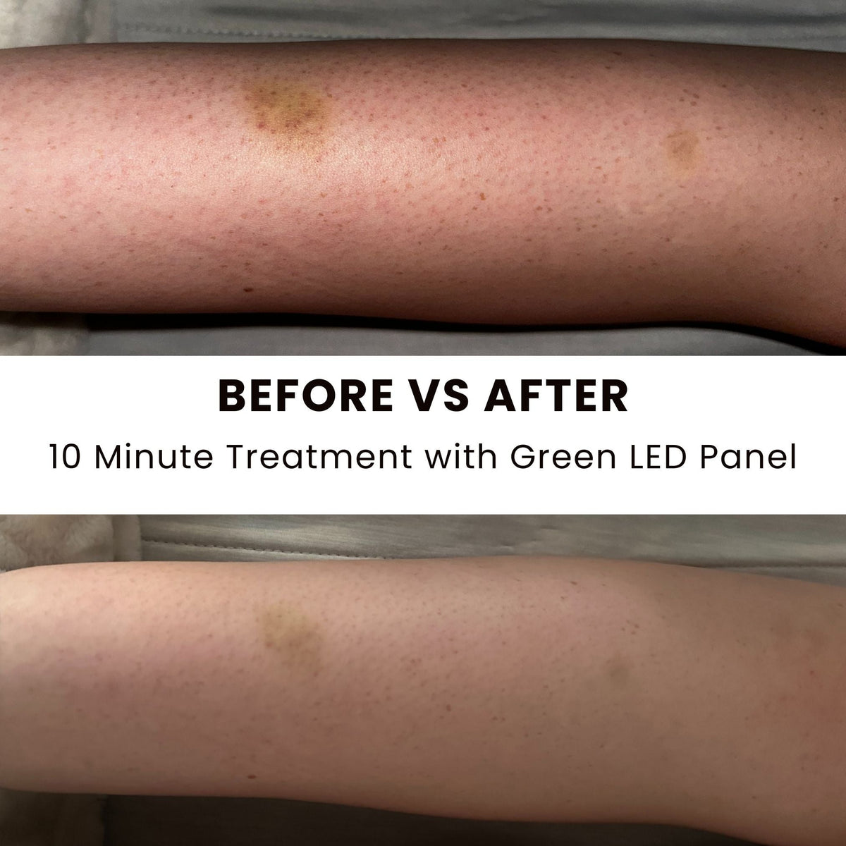 Illuminate Green V1 – Green Light Therapy Panel - Professional Grade